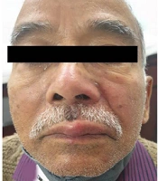 J Skin Stem Cell